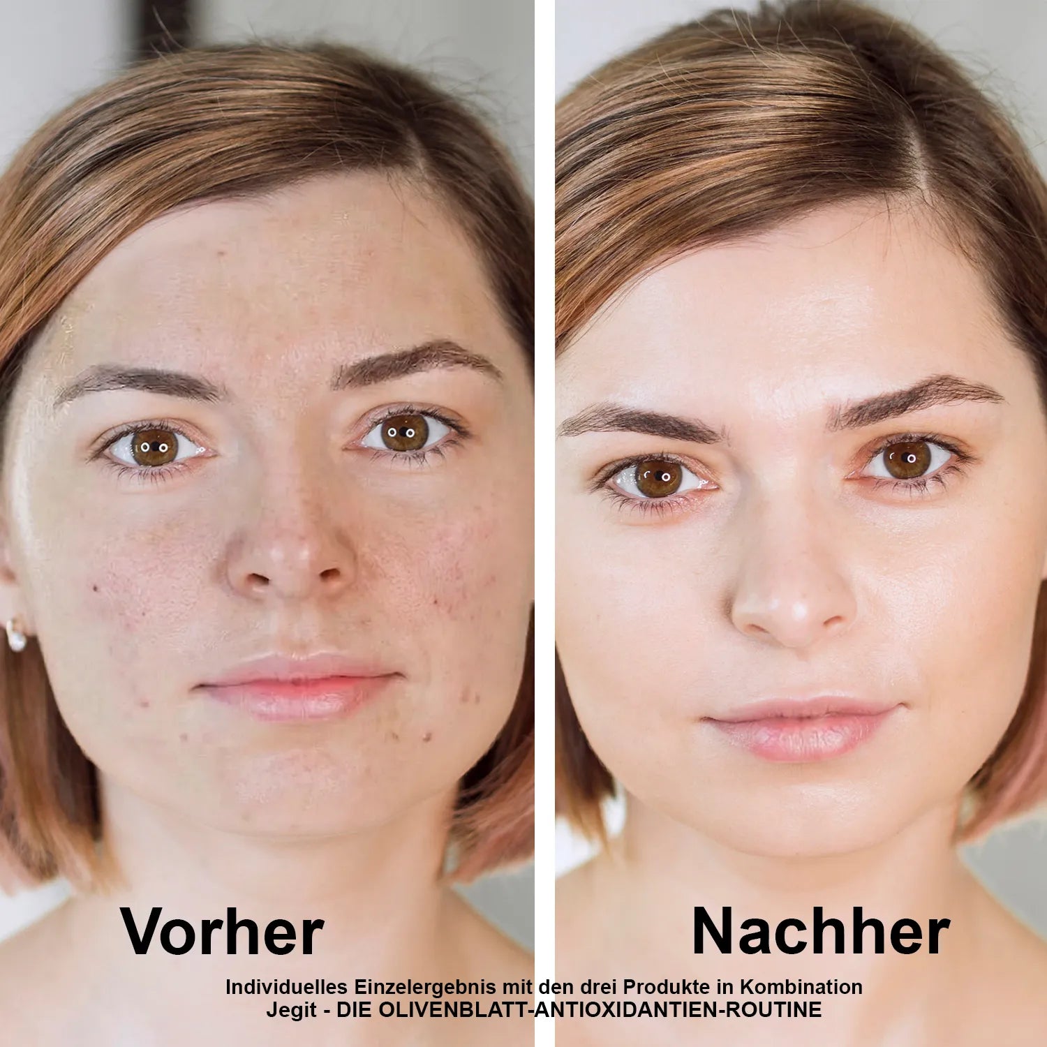 Antioxidatives Olivenblatt-Set